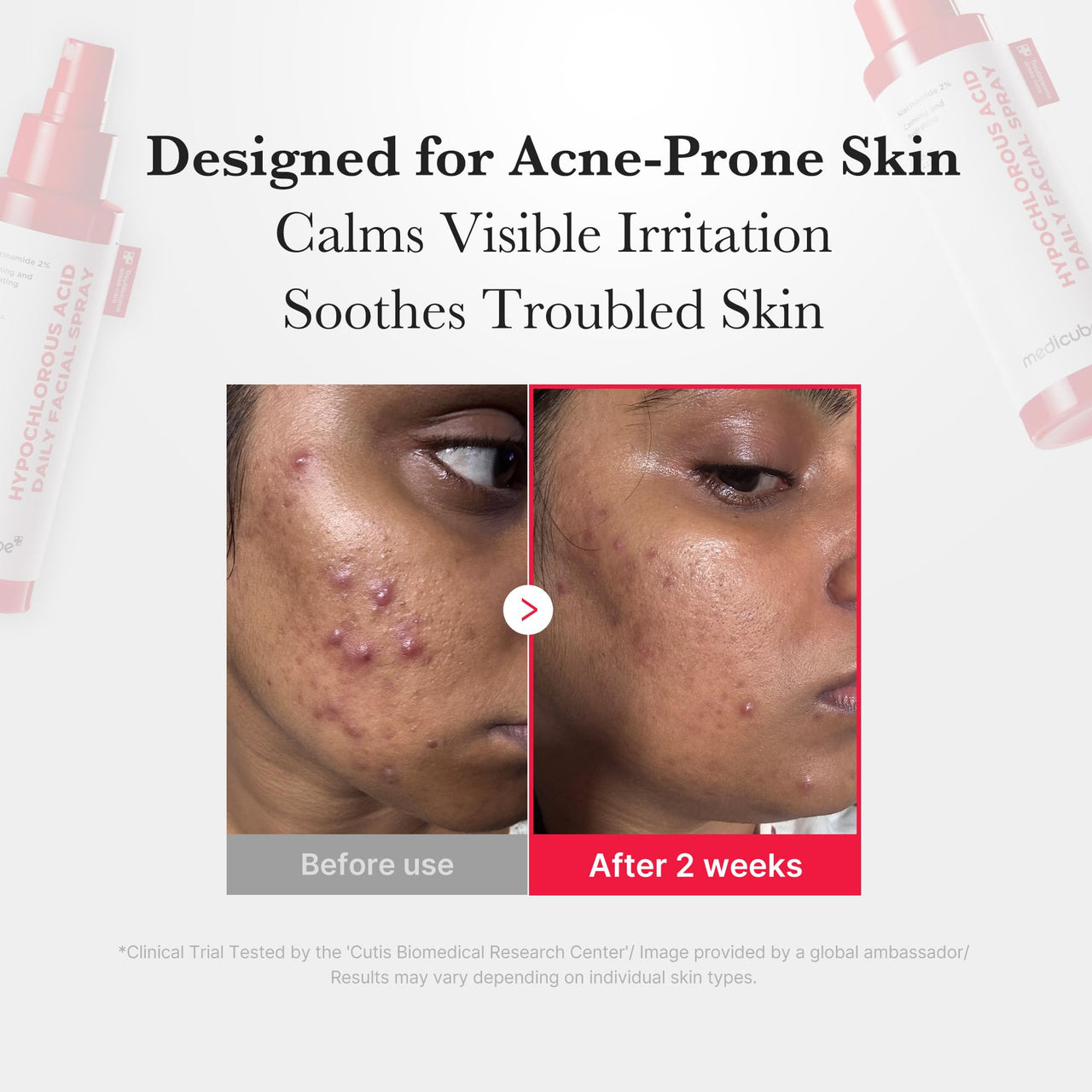 medicube Power Soothing Spray | Hypochlorous Acid Spray For All Skin Types, Delicate Skin | Daily Skin Solution & Post-Sun Care | HOCI Facial Mist for Soothing & Calming | Korean Skincare | 1.69 fl.oz