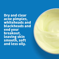 Thumbnail for De La Cruz Sulfur Ointment - Cystic Acne Treatment for Face and Body - Daily 10 Min Spot Treatment Mask - Safe and Effective Game Changing Hormonal Acne Treatment That Clears Up Pimples - 2.6 OZ