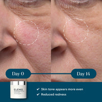 Thumbnail for ELEMIS Dynamic Resurfacing Facial Pads - Blackhead Refining Treatment - Gentle Daily Skin Resurfacer - Lactic Acid, Tri-Enzyme - 60-Count Jar