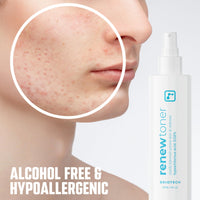 Thumbnail for BRIOTECH Skin Renew Toner, Hypochlorous Acid Spray Topical Skin Spray for Face and Skin, Minimize Appearance of Blemishes, Soothing Mist for Redness & Bumps, Stocking Stuffer, 4 fl oz ea, 2 ct