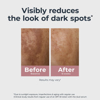 Thumbnail for Eucerin Radiant Tone Dual Serum Dark Spot Corrector, Dark Spot Serum with Thiamidol and Hyaluronic Acid, Helps Visibly Reduce the Look of Persistent Dark Spots, 1 Fl Oz Bottle
