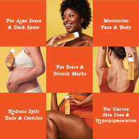 Thumbnail for Bio-Oil Natural Skincare Oil Serum, Face and Body Moisturizer with Chamomile, Rosehip, and Lavender Oil, for Scars, Stretch Marks, Sensitive Skin, All Skin Types, 2 Oz