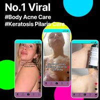 Thumbnail for SOME BY MI AHA BHA PHA 30 Days Miracle Acne Clear Body Cleanser 13.5oz – Salicylic Acid & Tea Tree Acne Body Wash – Deep Cleansing, Sulfate & Paraben Free Korean Skin care