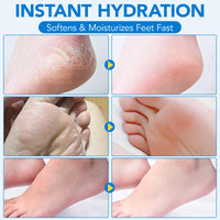 Thumbnail for Uruses Urea Cream 60% plus Salicylic Acid 2% Urea Foot Care Stick, Foot Cream for Foot Callus Remover, Feet Moisturizer Stick for Dry Cracked Heels, Hands, Knees, Hydrating Heel Balm, Easy To Use
