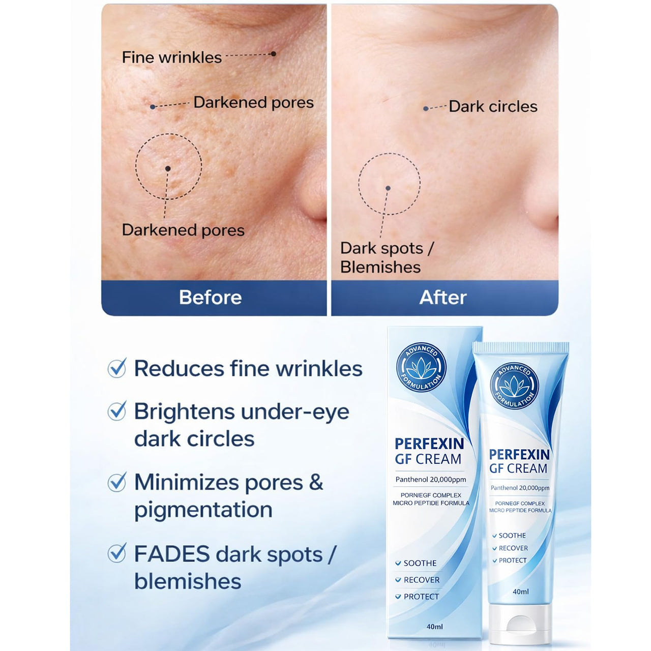 PERFEXIN GF Cream | Contains Panthenol 20,000ppm | DRN/EGF Complex Face Cream | Soothing & Hydrating | Supports Skin Barrier | 40ml