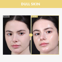 Thumbnail for TOSOWOONG Glow Bean Essence, 31,025ppm Soybean Ferment Extract, Glass Skin, Exfoliating, Hydrating, Radiant, Moisturizer, Barrier, Face Serum, Korean Skin Care, 33ml / 1.11 fl. oz.