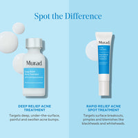 Thumbnail for Murad Deep Relief Acne Treatment - Acne Control Max Strength 2% Salicylic Acid, Healing Treatment for Deep, Uncomfortable Acne, 1 Fl Oz