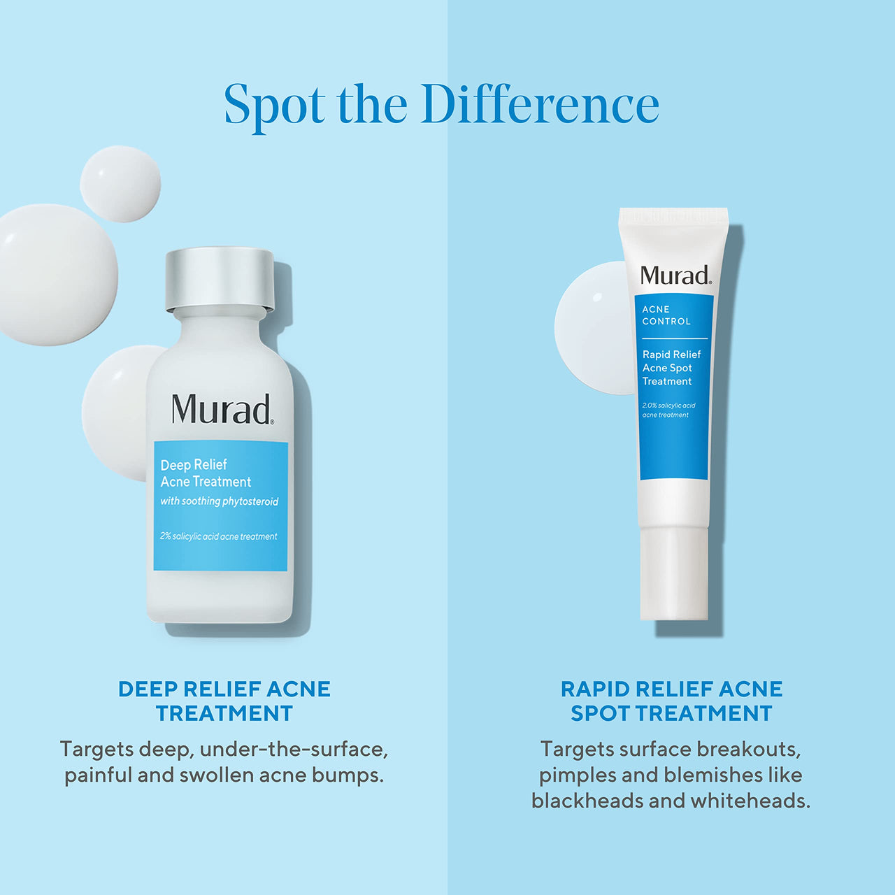 Murad Deep Relief Acne Treatment - Maximum Strength Acne Treatment with 2% Salicylic Acid and Phytosteroid for Deep, Painful Acne Breakouts and Redness - Accelerated Healing Treatment - 1 Fl Oz