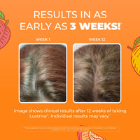 Thumbnail for MaryRuth's Multivitamin + Hair Growth Gummies | with Lustriva® | Biotin 10000mcg | B Vitamins | Formulated for Thicker Hair, Wrinkles, Fine Lines, Skin Care | Ages 18+ | 30 Servings