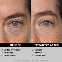 Thumbnail for Peter Thomas Roth | Instant FIRMx® Eye Temporary Eye Tightener