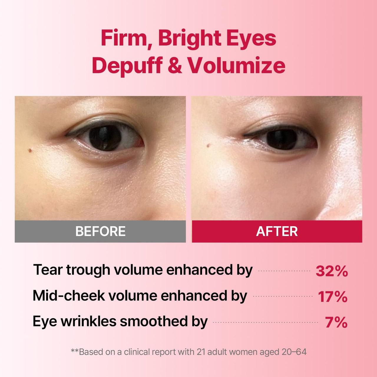 MEDITHERAPY Wrinkle-fit Tangle Eye Patch - Under Eye Patches for Dark Circles and Puffy Eyes - Eye Bags Treatment for Women - Mega Collagen Gel Pads for Puffiness - Firming & Deep Hydrating - 4EA