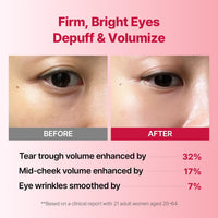 Thumbnail for MEDITHERAPY Wrinkle-fit Tangle Eye Patch - Under Eye Patches for Dark Circles and Puffy Eyes - Eye Bags Treatment for Women - Mega Collagen Gel Pads for Puffiness - Firming & Deep Hydrating - 4EA