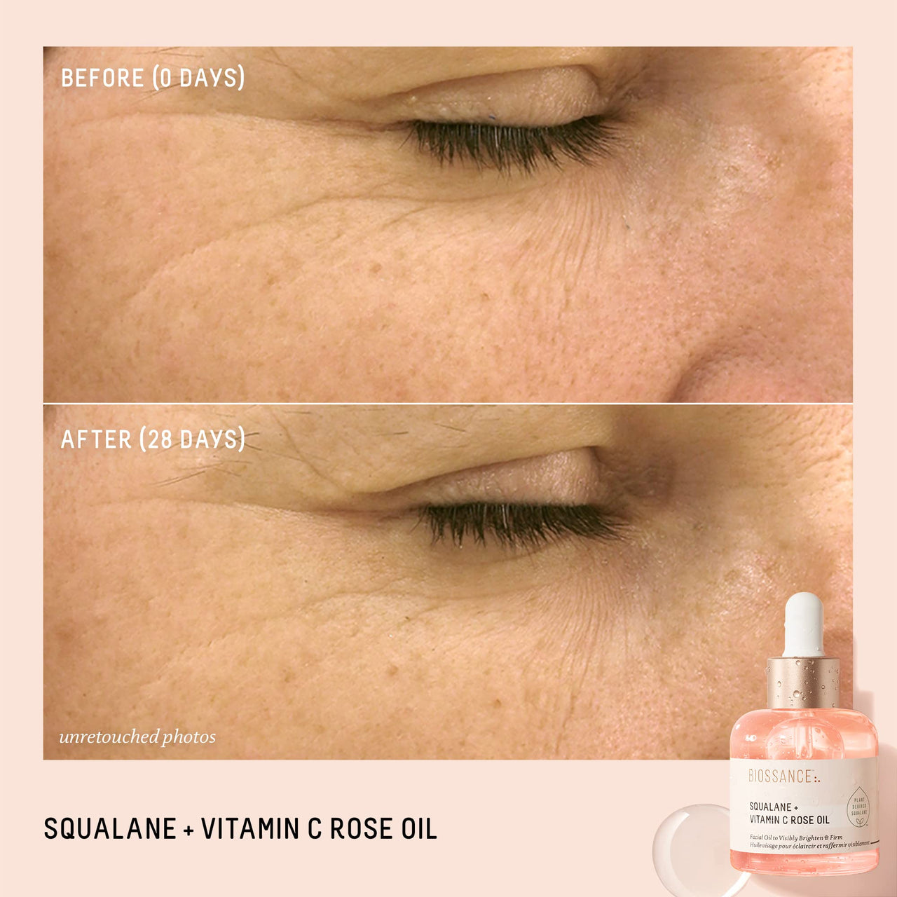 BIOSSANCE Squalane + Vitamin C Rose Advanced Facial Oil - Brightening, Firming, and Hydrating Serum for All Skin Types - Chios Crystal Oil, Damascus Rose Extract & Squalane for Radiance - 1oz
