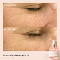 Thumbnail for BIOSSANCE Squalane + Vitamin C Rose Advanced Facial Oil - Brightening, Firming, and Hydrating Serum for All Skin Types - Chios Crystal Oil, Damascus Rose Extract & Squalane for Radiance - 1oz