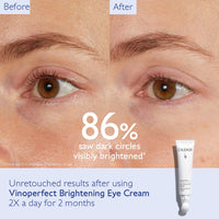 Thumbnail for Caudalie Vinoperfect Dark Circle Brightening Eye Cream With Niacinamide - Visibly Brightens, Evens Under-Eye Texture And Hydrates The Eye Contour