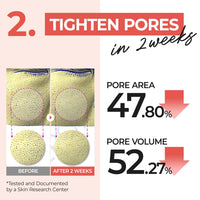 Thumbnail for numbuzin No.4 Toner Pads | Pore Zero Peeled Egg Toner Pad | Gentle Exfoliator, PHA, LHA, Makeup Skin Prep, Panthenol | Korean Skincare for Face | 70 Pads/6.42 fl. oz.