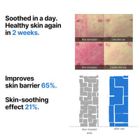 Thumbnail for SOME BY MI Beta-Panthenol Repair Serum – 1.01oz, 30ml – Korean Hydrating Hyaluronic Acid Serum for Face – Daily Barrier Repair & Soothing Formula with Beta-Sitosterol & Panthenol – Korean Skin Care
