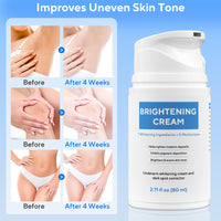 Thumbnail for Skin Bleaching Cream, Dark Spot Remover for Body and Face, 2.71 fl oz Skin Lightening Whitening Cream with Vitamin C for Intimate Parts, Armpit, Inner Thigh, Dark Elbows and Knees, Bikini Areas
