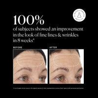 Thumbnail for Naturium Vitamin C Super Serum Plus, Smoothing Face Care, plus Retinol, Hyaluronic Acid, Niacinamide & Salicylic Acid, 1 oz