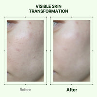 Thumbnail for Orien Propolis Niacinamide Glow Serum 1.01 fl.oz.