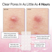 Thumbnail for grace & stella Pimple Patches for Face - Fast Acting Hydrocolloid Acne Patch That Absorb Gunk, Flatten Breakouts - Zit Stickers for Clear Skin - Dermatologist-Tested, Vegan (Invisible, 72 Count)