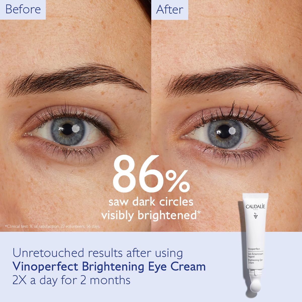 Caudalie Vinoperfect Dark Circle Brightening Eye Cream With Niacinamide - Visibly Brightens, Evens Under-Eye Texture And Hydrates The Eye Contour