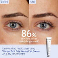 Thumbnail for Caudalie Vinoperfect Dark Circle Brightening Eye Cream With Niacinamide - Visibly Brightens, Evens Under-Eye Texture And Hydrates The Eye Contour