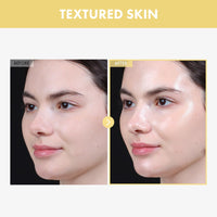 Thumbnail for TOSOWOONG Glow Bean Essence, 31,025ppm Soybean Ferment Extract, Glass Skin, Exfoliating, Hydrating, Radiant, Moisturizer, Barrier, Face Serum, Korean Skin Care, 33ml / 1.11 fl. oz.