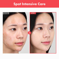 Thumbnail for TOSOWOONG Ovalicin Skin Clear Cream, Skin Soothing, Moisturizing with Niacinamide and Sulfur, Korean Skincare, 50g, 1.76 oz.