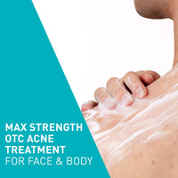 Thumbnail for CeraVe Acne Foaming Cream Wash, Gentle Face and Body Cleanser with Benzoyl Peroxide 10%, Hyaluronic Acid, and Niacinamide, 10% Benzoyl Peroxide Treatment Clears Pimples and Blackheads 5 Oz