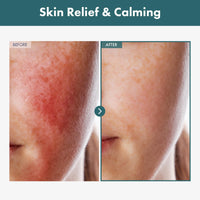 Thumbnail for TOSOWOONG Adenosine Cica Cream, 520,000ppm Centella Asiatica, Redness Reducing for Oily and Dry Skin Moisturizer, Barrier Cream with Niacinamide and Panthenol, Korean Skincare, 100ml, 3.38 fl. oz.