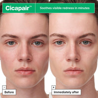 Thumbnail for Dr.Jart+ Cicapair Sensitive Skin Serum Face Mask for Redness with Centella Asiatica | Sheet Mask | Korean Skin Care | Travel Size, 1 Pack