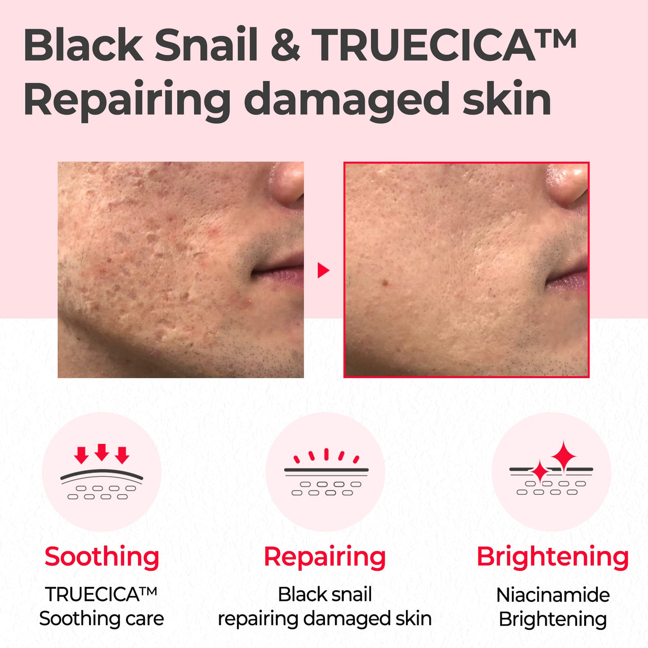 SOME BY MI Snail Truecica Miracle Repair Toner - 4.6Oz, 135ml - Made from Snail Mucin for Sensitive Skin - Daily Repair Face Toner with Skin Texture and Pigmentation Care - Korean Skin Care