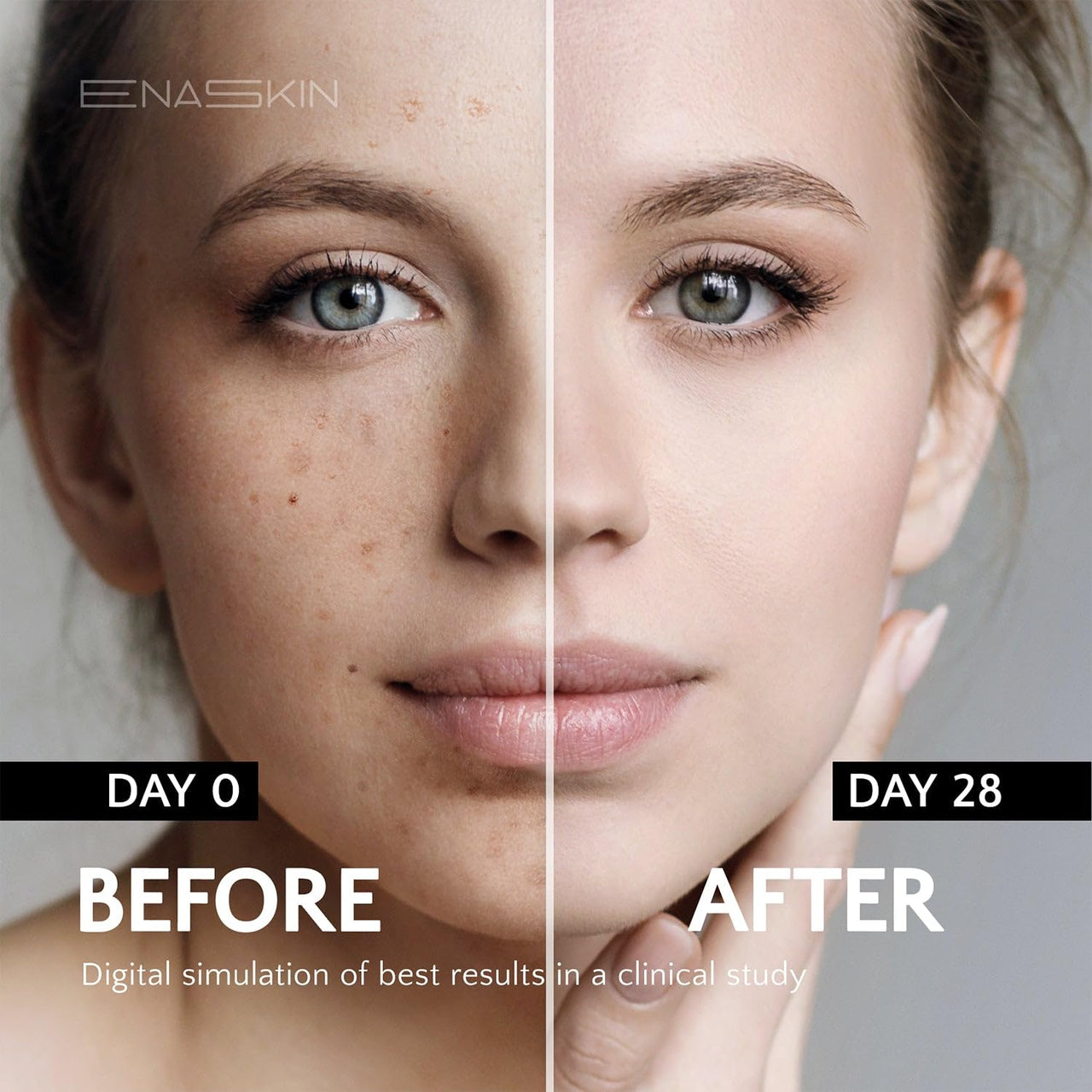 EnaSkin Radiance Renewal Serum – Potent Niacinamide Formula for Face & Body to Minimize Dark, Age, and Sun Spots, Freckles, and Melasma (1.0 Fl Oz)