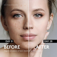 Thumbnail for EnaSkin Radiance Renewal Serum – Potent Niacinamide Formula for Face & Body to Minimize Dark, Age, and Sun Spots, Freckles, and Melasma (1.0 Fl Oz)