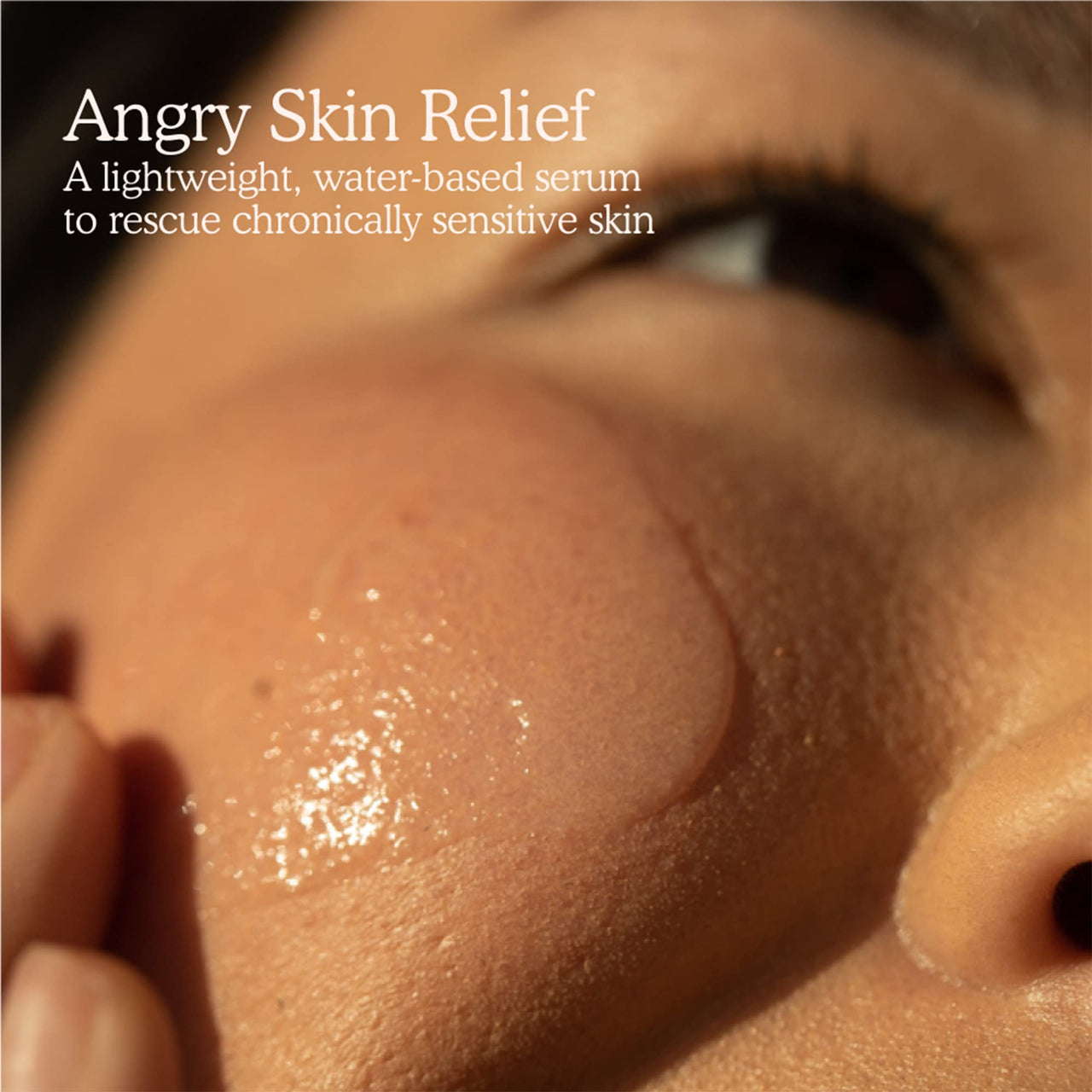 Tower 28 SOS Rescue Face Serum - Soothing Facial Serum with Hypochlorous Acid for Irritated, Sensitive Skin - Gently Helps Reduce Redness + Blemishes - Fragrance-Free Everyday Skin Care (2 oz)