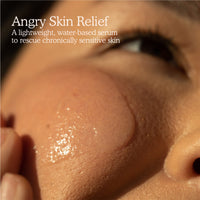 Thumbnail for Tower 28 SOS Rescue Face Serum - Soothing Facial Serum with Hypochlorous Acid for Irritated, Sensitive Skin - Gently Helps Reduce Redness + Blemishes - Fragrance-Free Everyday Skin Care (2 oz)