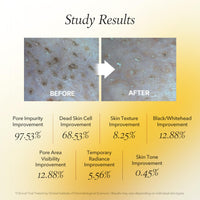 Thumbnail for APRILSKIN Calendula Flower-Infused Facial Peel Off Mask, 3.52 fl. oz, PHA, BHA & Niacinamide gently exfoliates, removes impurities, improves uneven skin tone, and minimizes pores, Korean Skincare