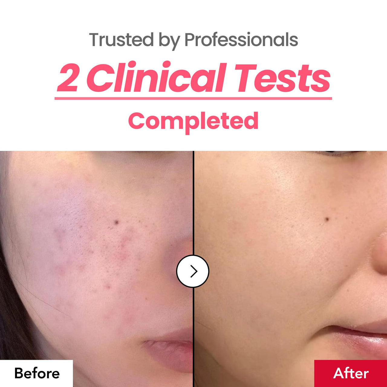 Dr.Percent Dark Spot 24% Correcting Pink Glow Cream | Tranexamic Acid 6%, Niacinamide 5%, Dark Spots, Blemishes, HyperPigmentation, Low-Irritating, Korean Skincare, 30ml, 1.01 fl.oz.