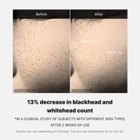 Thumbnail for Medicube Zero Pore One-day Serum 1.01 fl.oz - Overnight Resurfacing Serum with Pore Tightening Complex - 15.2% AHA+BHA+PHA & 2% Niacinamide - 10.8% reduction in pore appearance after one day of use