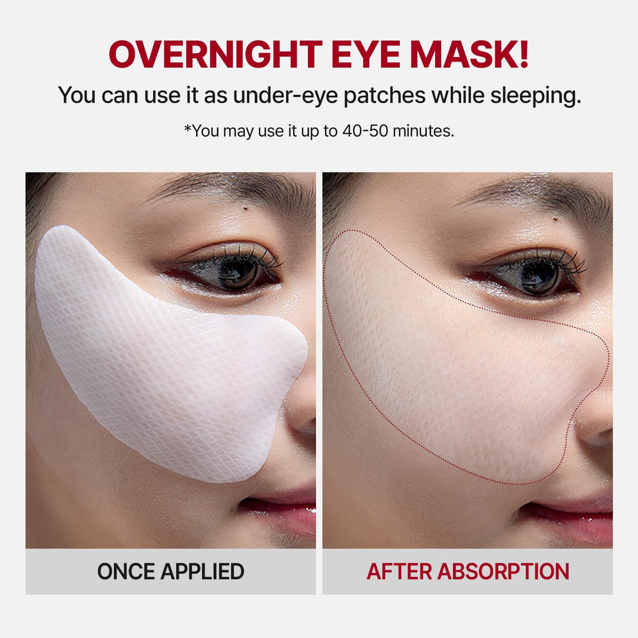 MEDITHERAPY Wrinkle-fit Tangle Eye Patch - Under Eye Patches for Dark Circles and Puffy Eyes - Eye Bags Treatment for Women - Mega Collagen Gel Pads for Puffiness - Firming & Deep Hydrating - 4EA