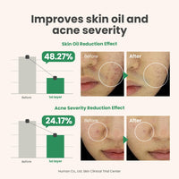 Thumbnail for AXIS-Y Spot The Difference Blemish Spot Treatment - 4-Terpineol 2% Niacinamide AHA BHA Soothes Breakouts & Skin Barrier Repair - Vegan Korean Skin Care Face Serum - 0.50 fl. oz.