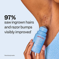 Thumbnail for Peach Slices - Smoothing Solution Ingrown Hair Treatment (1.69 oz) - Smooth, Relieve, Soften Skin - 360 Roller - BHA, AHA, PHA, Niacinamide, Licorice - Vegan & Cruelty Free - Korean Skin Care & Beauty