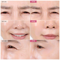Thumbnail for TOSOWOONG Anti-Wrinkle Patch with Hydrolyzed Collagen, Forehead & Eye & Smile Line Wrinkle Patches, Anti-Wrinkle Tape, K-Beauty Overnight Under Eye Patches, Korean Skincare, 5ea (10patches X 5)