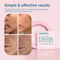Thumbnail for Frownies Facial Patches for Wrinkles on the Corner of Eyes & Mouth - Hypoallergenic Anti-Wrinkle Face Tape - Wrinkle Patch to Smooth & Soften Crow’s Feet & Smile Lines - For Overnight Use, 144 Patches