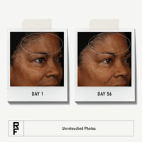 Thumbnail for Rodan + Fields Redefine Regimen | Skincare Kit Includes Clay Cleanser, Toner, Triple Defense Cream, & Overnight Cream | Skin Care Gift Set for Women