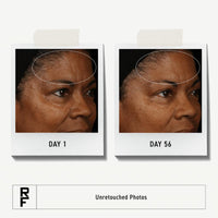 Thumbnail for Rodan + Fields Redefine Regimen | Skincare Kit Includes Clay Cleanser, Toner, Triple Defense Cream, & Overnight Cream | Skin Care Gift Set for Women