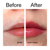 Thumbnail for The INKEY List Tripeptide Plumping Lip Balm 10ml, Clinically Proven Plumping Tinted Lip Care, Hydrates Dry Cracked Lips, Vegan & Cruelty Free, Berry Tint