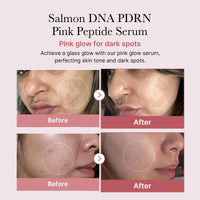 Thumbnail for medicube Salmon DNA PDRN Pink Peptide Serum, Pink glow serum, Peptide, Niacinamide, Hydrating & Moisturizing & Firming, Uneven Skin Tone, Korean Skincare | 1.01 fl.oz. (1.01 fl.oz., Salmon DNA PDRN)
