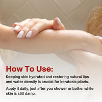 Thumbnail for KPAWAY Moisturizing Keratosis Pilaris Cream for Kids | Gentle Hydration for Dry, Bumpy Skin | Dermatologist-Developed Lotion | Non-Irritating, Acid-Free Formula | 16 oz